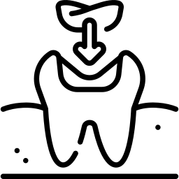Inlay-onlay betétek