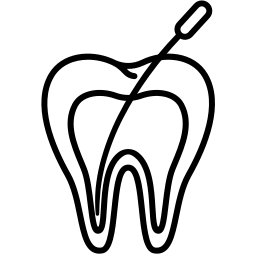 Gyökérkezelések