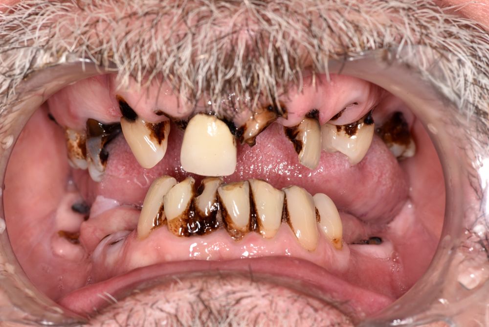 Before Image