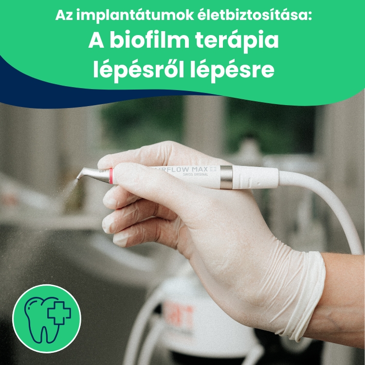 AIRFLOW®: Érintésmentes tisztítás porsugárral