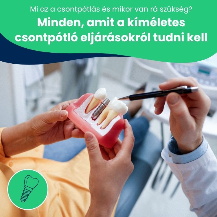 Az orvos zsemlélteti a csontpótlási eljárásokat.